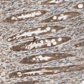 Anti-OXSR1 antibody produced in rabbit Prestige Antibodies® Powered by Atlas Antibodies, affinity isolated antibody, buffered aqueous glycerol solution