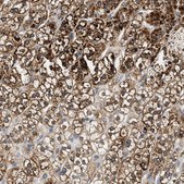 Anti-HDHD3 antibody produced in rabbit Prestige Antibodies® Powered by Atlas Antibodies, affinity isolated antibody, buffered aqueous glycerol solution, Ab1
