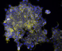 Mouse mammary tumor cell line TUBO