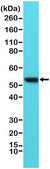 Anti-Vimentin antibody, Rabbit Monoclonal recombinant, expressed in HEK 293 cells, clone RM289, purified immunoglobulin