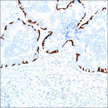 Anti-Keratin 17 antibody, Rabbit monoclonal clone SP95, recombinant, expressed in proprietary host, affinity isolated antibody