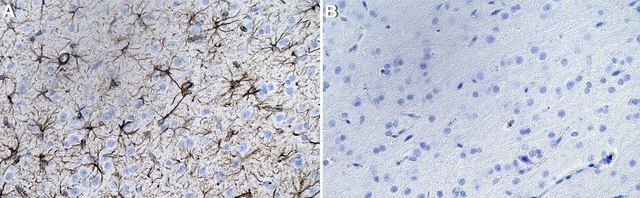 Anti-GFAP Antibody, clone GA5 ZooMAb&#174; Mouse Monoclonal recombinant, expressed in HEK 293 cells