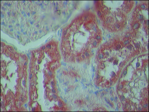 Anti-TDP-43 (N-terminal region) antibody produced in rabbit ~1.0&#160;mg/mL, affinity isolated antibody, buffered aqueous solution