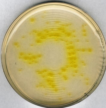 Cetrimide agar Pseudomonas selective agar base for microbiology (According harm. EP/USP/JP)