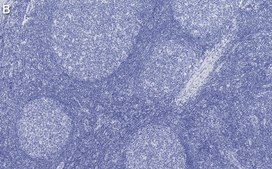 Anti-PCNA Antibody, clone 3B22 ZooMAb® Rabbit Monoclonal recombinant, expressed in HEK 293 cells