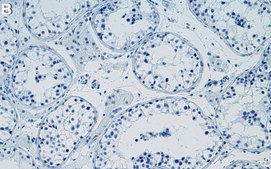 Anti-Ub-Histone H2A-Lys119 Antibody, clone 8B21 ZooMAb® Rabbit Monoclonal recombinant, expressed in HEK 293 cells