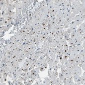 Anti-PDLIM1 antibody produced in rabbit Prestige Antibodies® Powered by Atlas Antibodies, affinity isolated antibody, buffered aqueous glycerol solution
