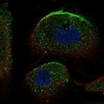 Anti-SLC34A2 antibody produced in rabbit Prestige Antibodies&#174; Powered by Atlas Antibodies, affinity isolated antibody, buffered aqueous glycerol solution