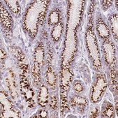 Anti-GALNT7 antibody produced in rabbit Prestige Antibodies® Powered by Atlas Antibodies, affinity isolated antibody, buffered aqueous glycerol solution