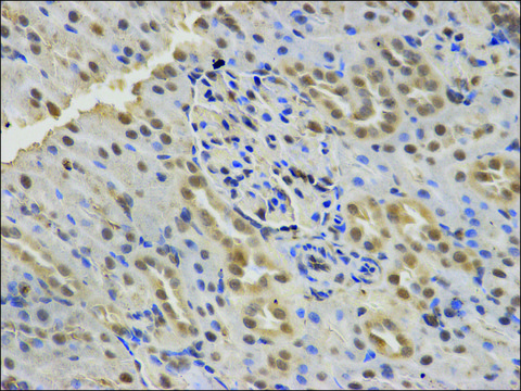 Anti-SMARCA4 antibody produced in rabbit affinity isolated antibody