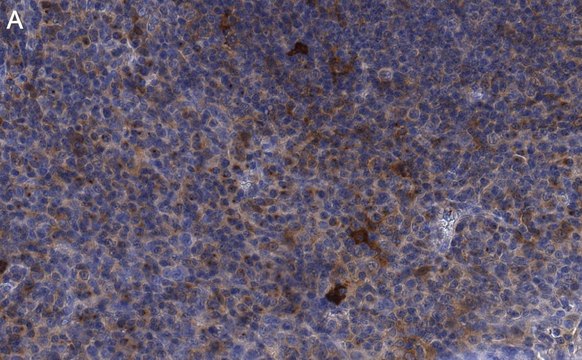 Anti-CD25 (IL2-RA) Antibody, clone 1K6 ZooMAb&#174; Rabbit Monoclonal recombinant, expressed in HEK 293 cells