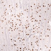 Monoclonal Anti-Foxo3 Antibody Produced In Mouse Prestige Antibodies® Powered by Atlas Antibodies, clone CL13589, affinity isolated antibody, buffered aqueous glycerol solution