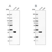 Anti-CT45A1 antibody produced in rabbit Prestige Antibodies® Powered by Atlas Antibodies, affinity isolated antibody, buffered aqueous glycerol solution