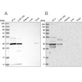 Anti-OTUD6B antibody produced in rabbit Prestige Antibodies® Powered by Atlas Antibodies, affinity isolated antibody, buffered aqueous glycerol solution, Ab2