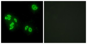 Anti-TFIP8 antibody produced in rabbit affinity isolated antibody
