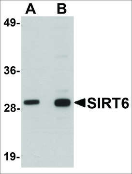 Anti-SIRT6 antibody produced in chicken affinity isolated antibody, buffered aqueous solution