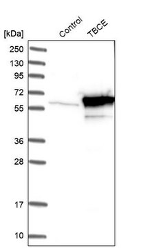 Anti-TBCE antibody produced in rabbit Prestige Antibodies® Powered by Atlas Antibodies, affinity isolated antibody, buffered aqueous glycerol solution, Ab2