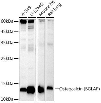 Anti-Osteocalcin (BGLAP) Antibody, clone 2T1J7, Rabbit Monoclonal