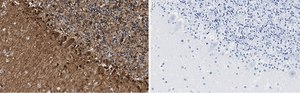 Anti-S100-B Antibody, clone 8F20 ZooMAb® Rabbit Monoclonal recombinant, expressed in HEK 293 cells