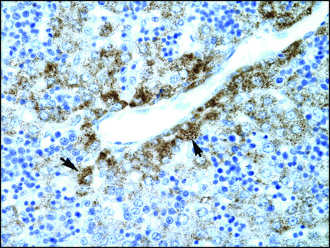 Anti-SLC30A9 (AB1) antibody produced in rabbit affinity isolated antibody