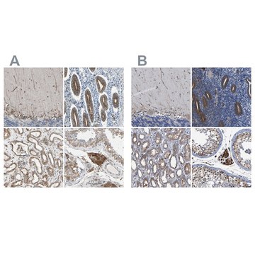 Anti-CLCC1 antibody produced in rabbit Ab1, Prestige Antibodies&#174; Powered by Atlas Antibodies, affinity isolated antibody, buffered aqueous glycerol solution