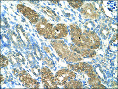 抗 SLC1A5 IgG fraction of antiserum