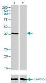 Monoclonal Anti-RNF14 antibody produced in mouse clone 4G9, purified immunoglobulin, buffered aqueous solution