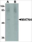 Anti-MATN4 antibody produced in rabbit affinity isolated antibody, buffered aqueous solution