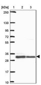 Anti-HFE antibody produced in rabbit Prestige Antibodies® Powered by Atlas Antibodies, affinity isolated antibody, buffered aqueous glycerol solution