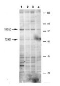 Anti-TRPV5 antibody produced in rabbit affinity isolated antibody