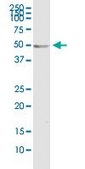 Monoclonal Anti-ODC1 antibody produced in mouse clone 2G5, purified immunoglobulin, buffered aqueous solution