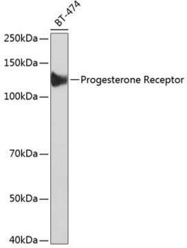 Anti-Progesterone Receptor Antibody, clone 4Y4H5, Rabbit Monoclonal