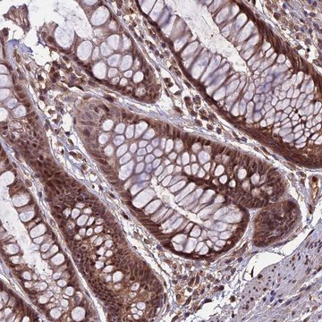 Anti-SPG11 antibody produced in rabbit Prestige Antibodies&#174; Powered by Atlas Antibodies, affinity isolated antibody, buffered aqueous glycerol solution