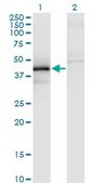 Monoclonal Anti-ZFYVE19 antibody produced in mouse clone 3G4-2B11, purified immunoglobulin, buffered aqueous solution