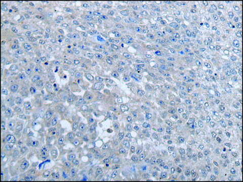 Anti-MTHFR affinity isolated antibody