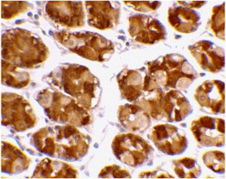 Anti-TRIM5 alpha Antibody from rabbit, purified by affinity chromatography