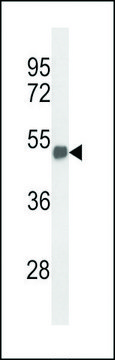 ANTI-FOXG1 (CENTER) antibody produced in rabbit affinity isolated antibody, buffered aqueous solution