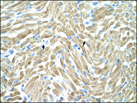 Anti-TPM1 IgG fraction of antiserum