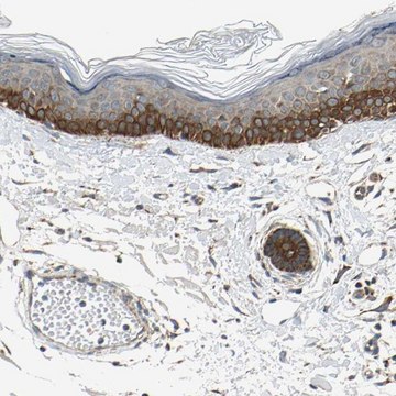 Anti-EPHB3 antibody produced in rabbit Prestige Antibodies&#174; Powered by Atlas Antibodies, affinity isolated antibody, buffered aqueous glycerol solution