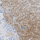 Anti-ACMSD antibody produced in rabbit Prestige Antibodies® Powered by Atlas Antibodies, affinity isolated antibody, buffered aqueous glycerol solution
