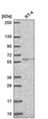 Anti-RRP8 antibody produced in rabbit Prestige Antibodies® Powered by Atlas Antibodies, affinity isolated antibody