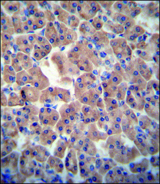 ANTI-ATPBD3 (CENTER) antibody produced in rabbit IgG fraction of antiserum, buffered aqueous solution