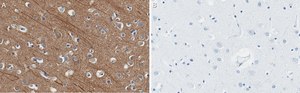 Anti-Presenilin-1 Antibody, clone 2O13 ZooMAb® Rabbit Monoclonal recombinant, expressed in HEK 293 cells