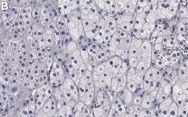 Anti-MerTK Antibody, clone 2E14 ZooMAb® Rabbit Monoclonal recombinant, expressed in HEK 293 cells