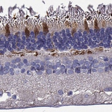 Anti-GRK7 antibody produced in rabbit Prestige Antibodies&#174; Powered by Atlas Antibodies, affinity isolated antibody, buffered aqueous glycerol solution