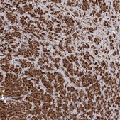Anti-PIK3C2A antibody produced in rabbit Prestige Antibodies® Powered by Atlas Antibodies, affinity isolated antibody, buffered aqueous glycerol solution