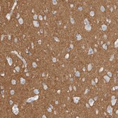 Anti-TNR antibody produced in rabbit Prestige Antibodies® Powered by Atlas Antibodies, affinity isolated antibody, buffered aqueous glycerol solution, Ab1