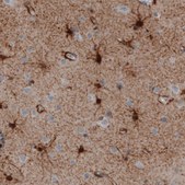 Monoclonal Anti-GLUL antibody produced in mouse Prestige Antibodies® Powered by Atlas Antibodies, clone CL3004, purified immunoglobulin, buffered aqueous glycerol solution