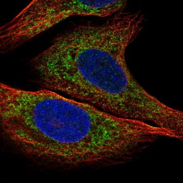 Anti-IGFBP2 antibody produced in rabbit Prestige Antibodies&#174; Powered by Atlas Antibodies, affinity isolated antibody