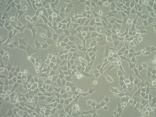 LOX-IMVI Human Melanoma Cell Line LOX-IMVI human melanoma cell line is an excellent model for probing mechanisms of metastasis and for evaluation of chemotherapies.